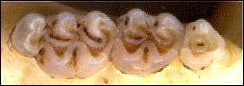 Peromyscus teeth