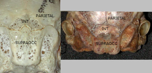 Comparison of interparietal area of Lepus and Sylvilagus