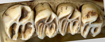 Upper right toothrow of Erethizon dorsata, anterior to left