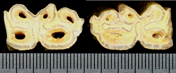 two sectioned lower teeth showing zebrine characters